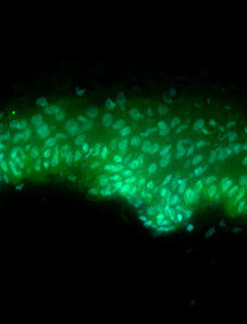 Re-balancing the microbiome