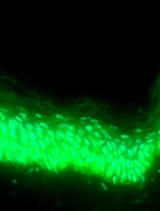 Re-balancing the microbiome