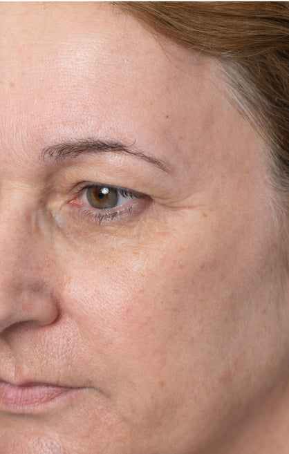 After — Longevity Booster Treatment