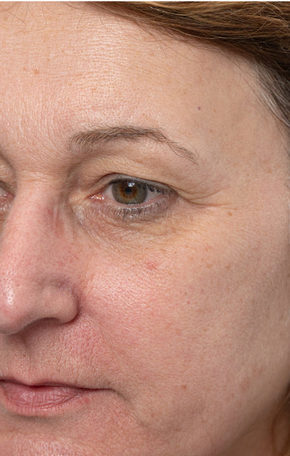 Before — Longevity Booster Treatment