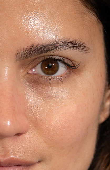 After — Eye Area Treatment