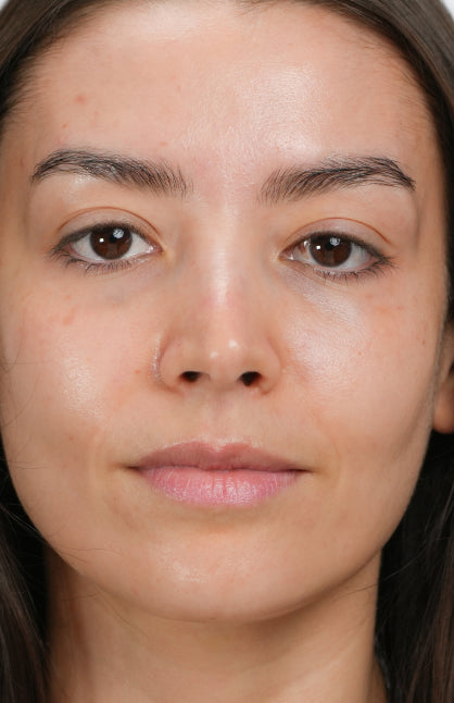 After — Repairing and moisturizing treatment