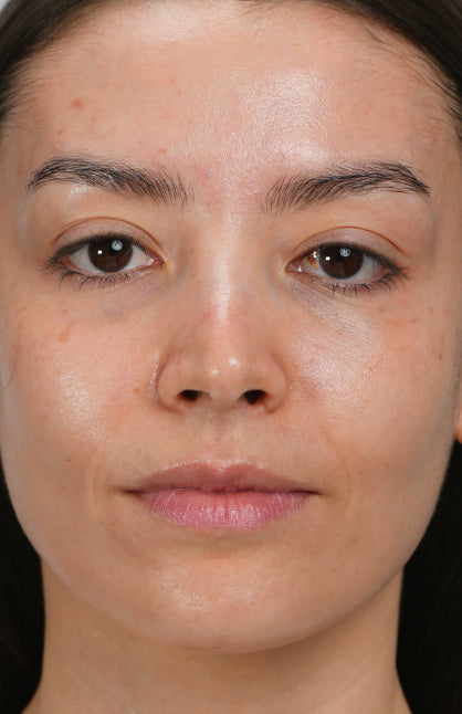 Before — Repairing and moisturizing treatment